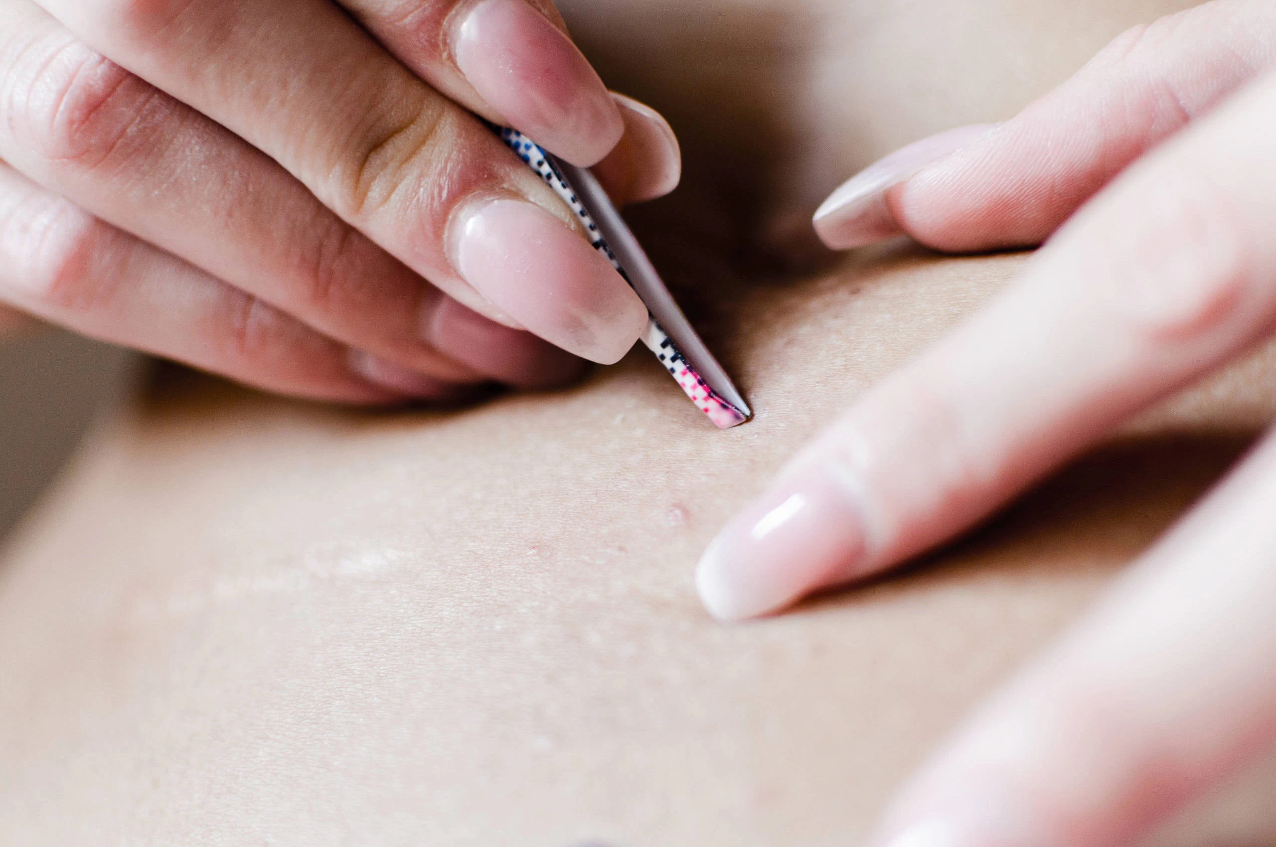 Τρίχες που γυρίζουν προς τα μέσα: Πώς να τις αντιμετωπίσουμε